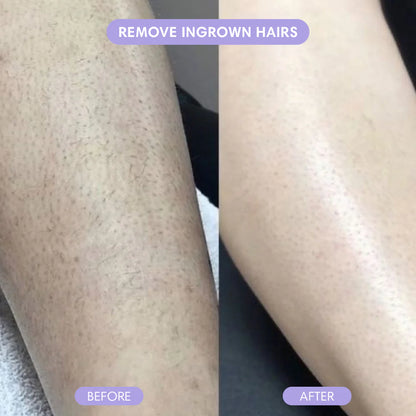 Cloud S Hair Removal Spray