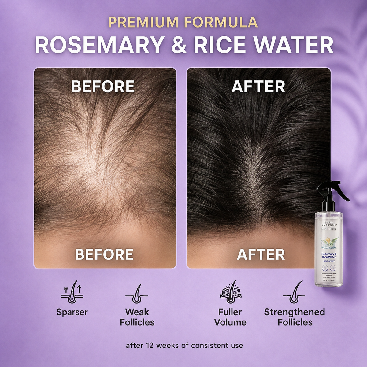 Rosemary + Rice Hair Growth Spray