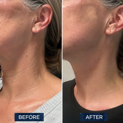 Remedy Face & Neck Firming Retinal Serum Stick