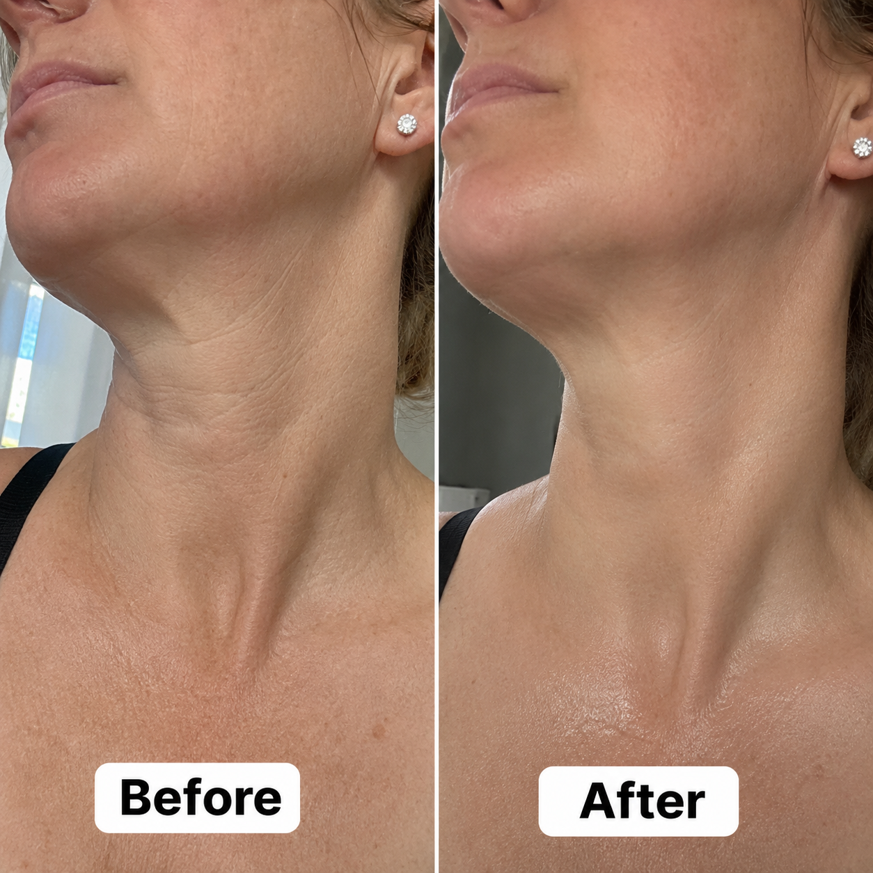 Remedy Face & Neck Firming Retinal Serum Stick
