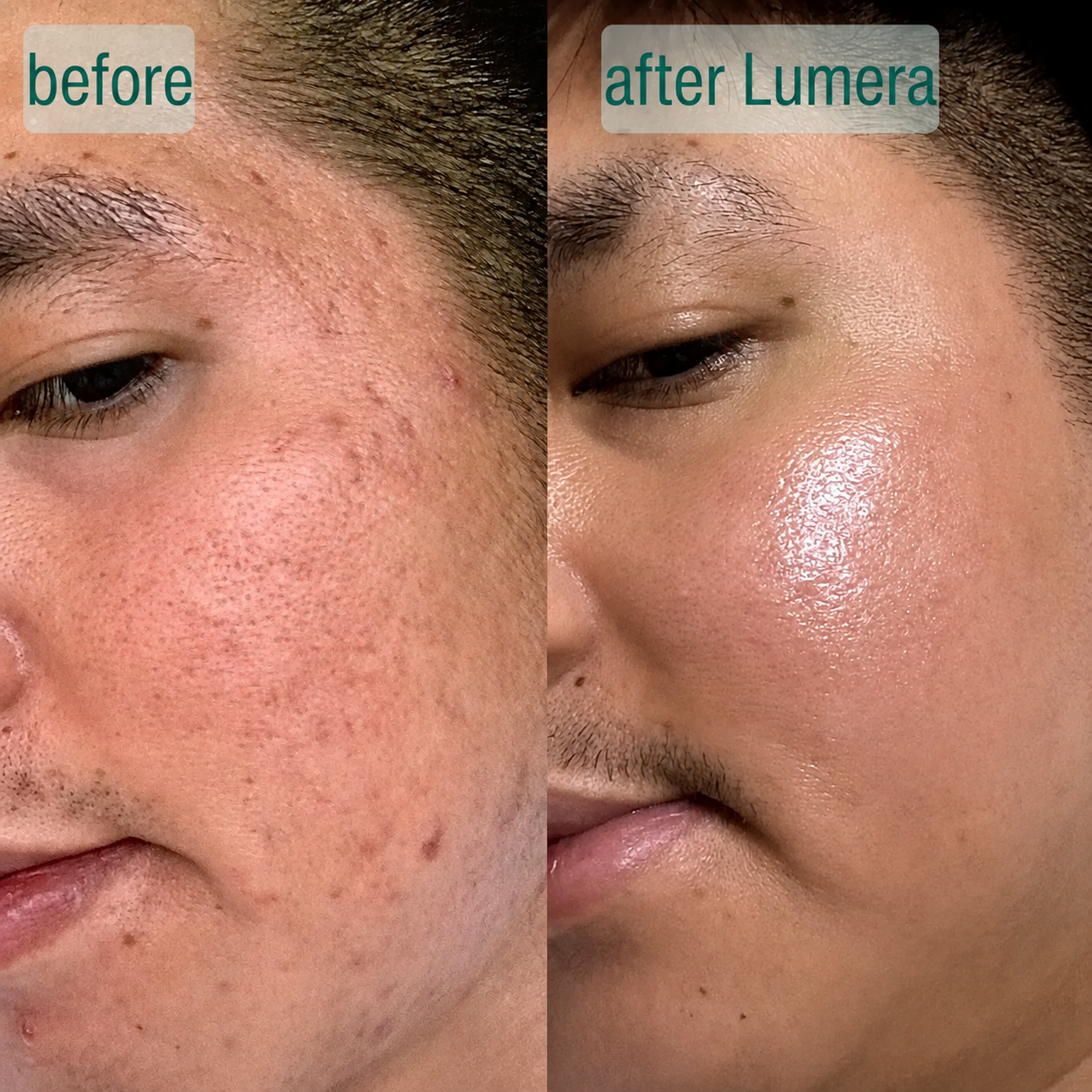 MicroCrystal Renewal Serum Duo™