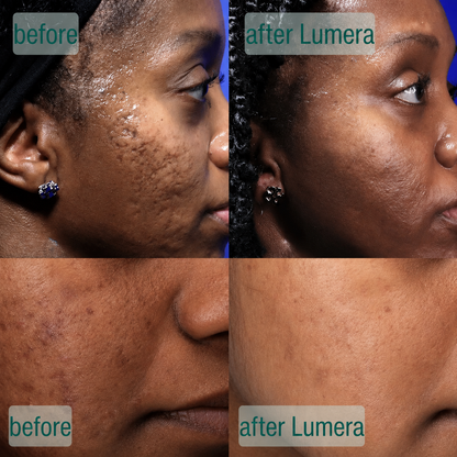 MicroCrystal Renewal Serum Duo™