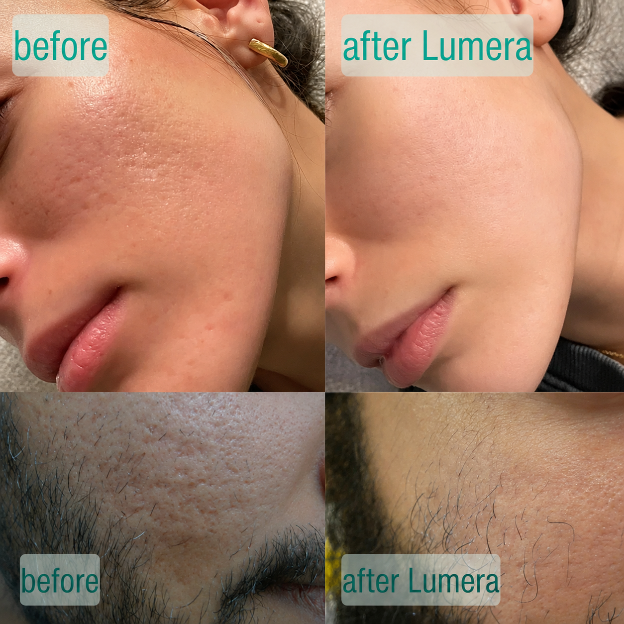 MicroCrystal Renewal Serum Duo™