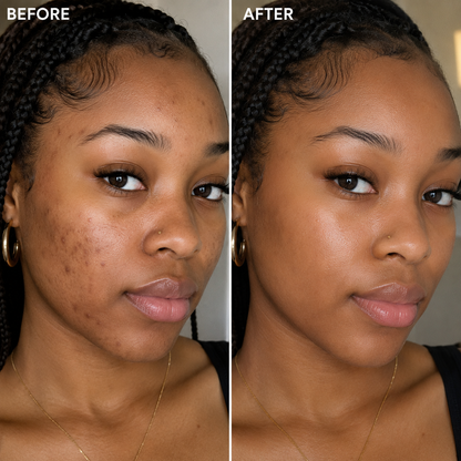 Arbutin Skincare Cream