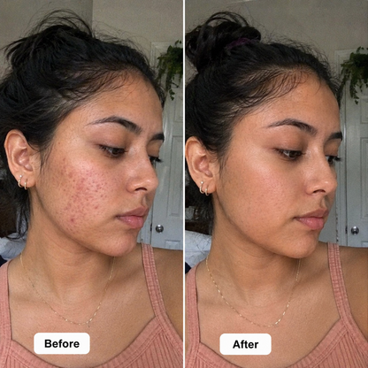 Arbutin Skincare Cream