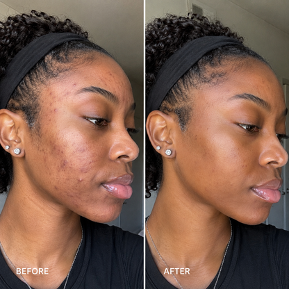Aobenz Lumièra™
