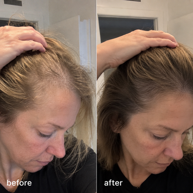 Lufzo Deoxyribose Scalp Ampoule 20ml