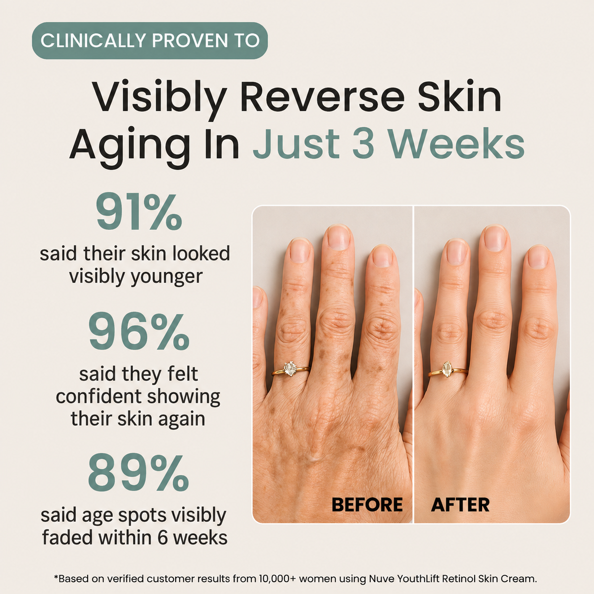 Nuve YouthLift Retinol Skin Cream