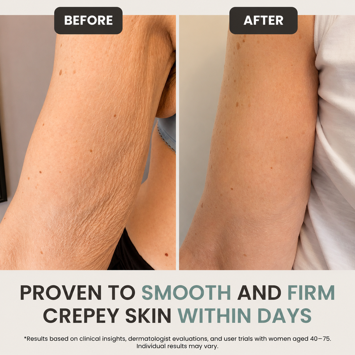 Nuve YouthLift Retinol Skin Cream