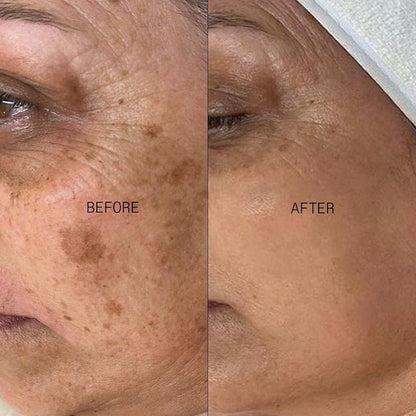 Glutathione 7 Serum Patch